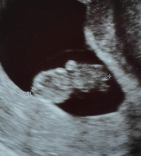 Echo 8 weken, 5 dagen Brabbels FotoAlbum