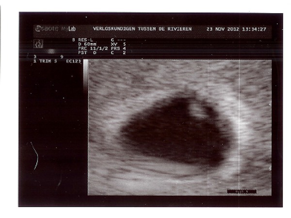 echo 6 weken | Brabbels FotoAlbum