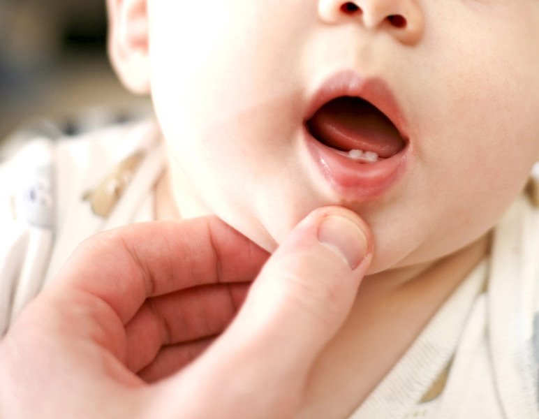 pijn tanden baby pijn tanden baby
